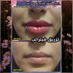 متخصص زیبایی دکتر سید حسن مظلومی