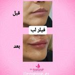 کلینیک لیزر پوست مو زیبایی دکترحسین زاده