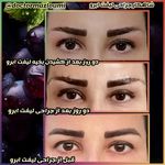 متخصص زیبایی دکتر سید حسن مظلومی