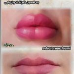 متخصص زیبایی دکتر سید حسن مظلومی