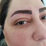 خدمات تخصصی ابرو حدیث معصومی