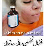 پاکسازی پوست فیشیال تخصصی درمانی