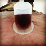 طب سنتی عامری (حجامت و بادکش)