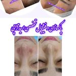 پاکسازی پوست فیشیال تخصصی درمانی
