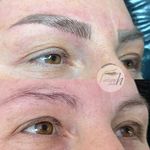 میکروبلیدینگ فرزانه قلعه