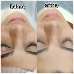 فیشال تخصصی پوست