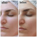 فیشال تخصصی پوست