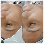 فیشال تخصصی پوست