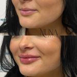 کلینیک لاغری، پوست و مو و زیبایی نونا