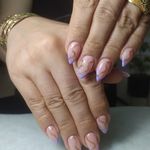 خدمات کاشت وناخن زَر نیل