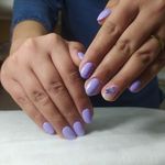خدمات کاشت وناخن زَر نیل