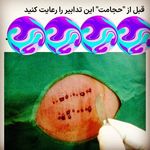 طب سنتی عامری (حجامت و بادکش)