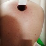 طب سنتی عامری (حجامت و بادکش)