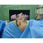 عمل بینی ملل کلینیک