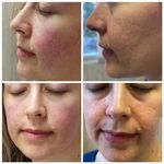 بهترین کلینیک زیبایی فلاح هایفو سودا