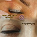 ریموو _ تاتو_رها