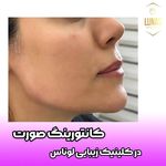 کلینیک زیبایی لوناس
