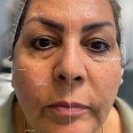 کلینیک زیبایی نومیا