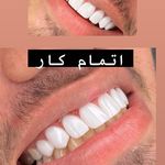 کامپوزیت دندان تخصصی اهواز