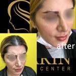 کلینیک زیبایی شارین _بوتاکس ،لیزر،بلفارو