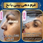 کلینیک تخصصی لیزر و لیفت نخ لولیتا