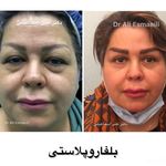 دکتر علی اسماعیلی جراح پلاستیک و زیبایی