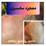 كلينيک پوست، مو و زیبایی ليليان