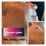 كلينيک پوست، مو و زیبایی ليليان