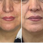 کلینیک زیبایی ولیزر دریا(کندلا آمریکایی)