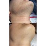 کلینیک لیزر آهو (مرکز لیزر موهای زائد)