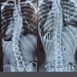 کلینیک ارتوپدی فنی الوند مرکز اسکن کف پا