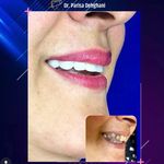 دندانپزشکی زیبایی دکتر پریسا دهقانی