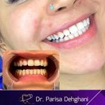دندانپزشکی زیبایی دکتر پریسا دهقانی