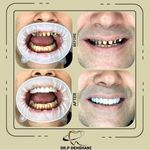 دندانپزشکی زیبایی دکتر پریسا دهقانی