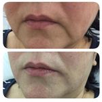 مرکز پوست‌ و ماساژ فریما