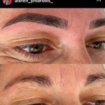 مرکز فیبروز و آرایش دائم عاطفه