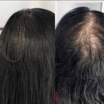 مرکز فیبروز و آرایش دائم عاطفه