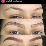 مرکز فیبروز و آرایش دائم عاطفه