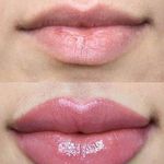 مرکز لیزر و کلینیک پوست مو زیبایی سپید