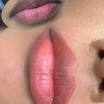 مرکز فیبروز و آرایش دائم عاطفه