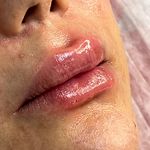 مرکز لیزر و کلینیک پوست مو زیبایی سپید