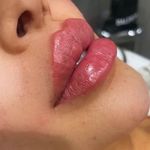 کلینیک لیزر و زیبایی مهسان