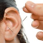 طب سوزنی گوش 👂