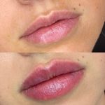 مرکز لیزر و کلینیک پوست مو زیبایی سپید