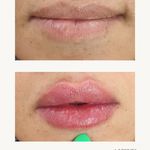 مرکز زیبایی و لاغری روژه