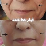 مرکز زیبایی و لاغری روژه