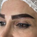 کلینیک کاشت ابرو و مو عزیزی در شیراز