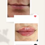 مرکز زیبایی و لاغری روژه