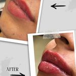 مرکز زیبایی و لاغری روژه