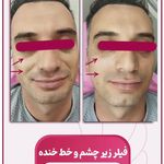 مرکز زیبایی و لاغری روژه